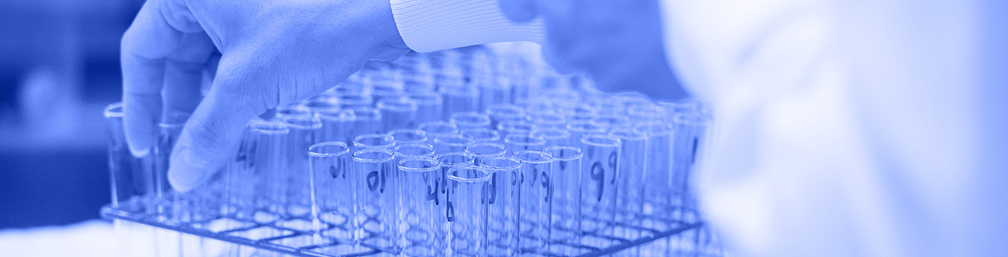 An analyst reaches for a test tube from a batch of test tubes.